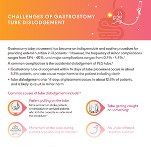 Challenges of buried bumper syndrome and tube dislodgement with enteral feeding tubes